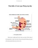 Tìm hiểu về các type Polyp dạ dày