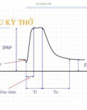 THÔNG KHÍ CƠ HỌC KHÔNG XÂM LẤN (PHẦN 4)