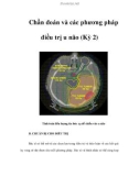 Chần đoán và các phương pháp điều trị u não (Kỳ 2)