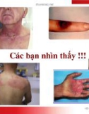 An toàn bức xạ trong phòng can thiệp