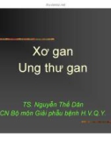 Giáo án y học - Xơ gan Ung thư gan