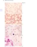 Atlas of Clinical Hematology - part 2