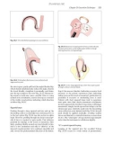 Colonoscopy Principles and Practice - part 6