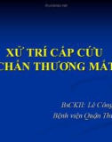 Bài giảng Xử lý cấp cứu chấn thương mắt - BS. Lê Công Lĩnh