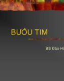 Bài giảng Bướu tim