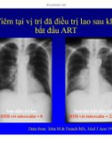 Bài giảng điều trị HIV : Hội chứng phục hồi miễn dịch part 7