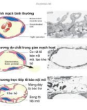 Bài giảng bệnh học viêm part 5