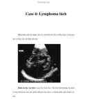 Case 4: Lymphoma lách