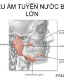 Bài giảng Siêu âm tuyến nước bọt lớn