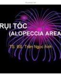 Bài giảng Trụi tóc (Alopeccia Areata) - TS. BS Trần Ngọc Ánh