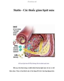 Statin - Các thuốc giảm lipid máu