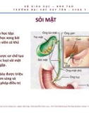 Bài giảng Sỏi mật - ThS. BS Nguyễn Phúc Học