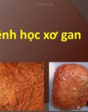 Bài giảng Bệnh học xơ gan