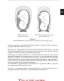 obstetrics_part3