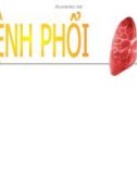 Bài giảng Bệnh phổi