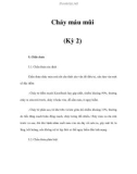 Chảy máu mũi (Kỳ 2)