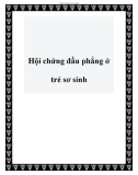 Hội chứng đầu phẳng - thường gặp ở trẻ sơ sinh