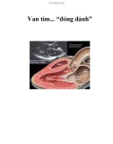 Van tim... 'đỏng đảnh'