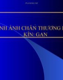 Bài giảng Hình ảnh chấn thương bụng kín: Gan