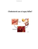 Cholesterol cao có nguy hiểm?