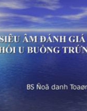 SIÊU ÂM ĐÁNH GIÁ KHỐI U BUỒNG