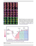 AN ATLAS OF DEPRESSION - PART 9