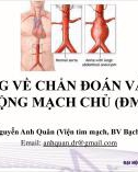 Đại cương về chẩn đoán và điều trị phình động mạch chủ (ĐMC) bụng - BS. Nguyễn Anh Quân