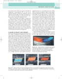 Peripheral Vascular Ultrasound - part 3