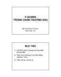 X quang trong chấn thương đầu