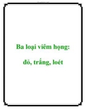 Ba loại viêm họng: đỏ, trắng, loét