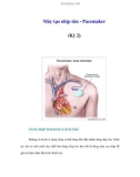 Máy tạo nhịp tim - Pacemaker (Kỳ 2)