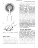 Fundamentals of Clinical Ophthalmology (part 4)