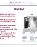 Bài giảng Bệnh lao - ThS. BS Nguyễn Phúc Học