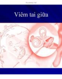 Bài giảng Viêm tai giữa