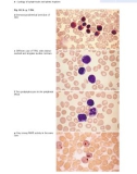 Atlas of Clinical Hematology - part 9