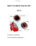 HẸP VAN ĐỘNG MẠCH CHỦ (Kỳ 2)