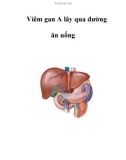 Viêm gan A lây qua đường ăn uống