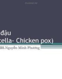 Bài giảng Thuỷ đậu (Varicella - Chicken pox) - BS.Nguyễn Minh Phương