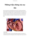 Những triệu chứng của suy tim