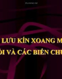 DẪN LƯU KÍN XOANG MÀNG PHỔI VÀ CÁC BIẾN CHỨNG