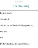 Điều trị một số Ca lâm sàng