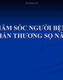 Bài giảng Chăm sóc người bệnh chấn thương sọ não