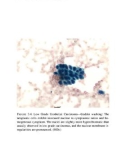 Cytologic Detection of Urothelial Lesions - part 5