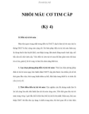 NHỒI MÁU CƠ TIM CẤP (Kỳ 4)