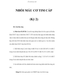 NHỒI MÁU CƠ TIM CẤP (Kỳ 2)