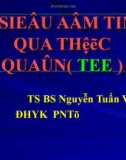 Siêu âm tim qua thực quản - Bs. Nguyễn Tuấn Vũ