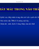 HÌNH ẢNH CẮT LỚP VI TÍNH CHẤN THƯƠNG SỌ NÃO part 7