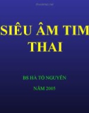 Bài giảng Siêu âm tim thai - BS Hà Tố Nguyên