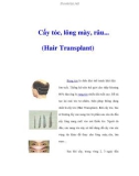 Cấy tóc, lông mày, râu... (Hair Transplant)