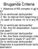 EKG Basics and Interpretation - part 4